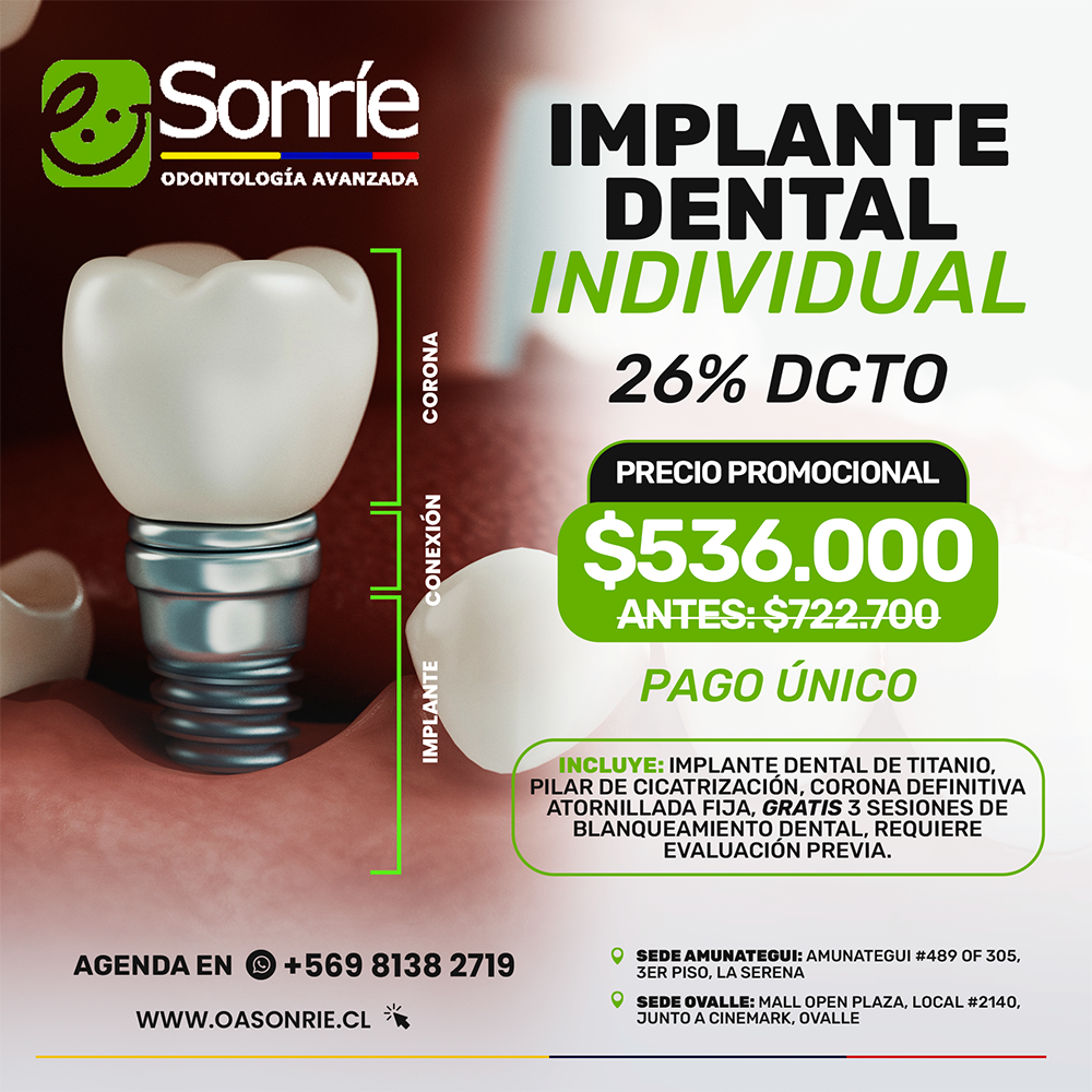 IMPLANTE-DENTAL-1.webp