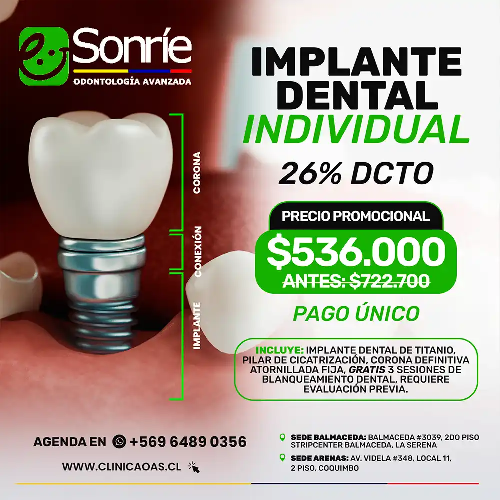 IMPLANTE-DENTAL_11zon.webp
